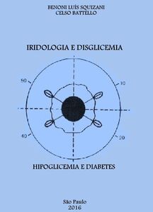 Iridologia e Disglicemia
